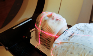 Laser Skin Treatment